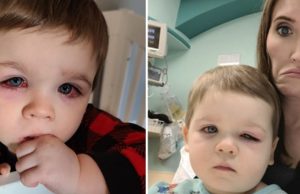 Mommy issues warning after her baby son nearly lost eyesight due to bath toy