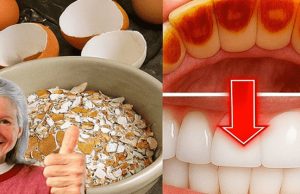 Brighten Your Smile with Simple Ingredients