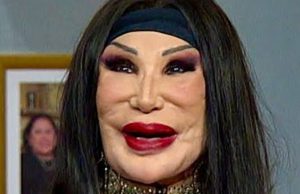 She was a famous actress, having starred in over a hundred films, but a tragic mistake completely ruined her appearance.